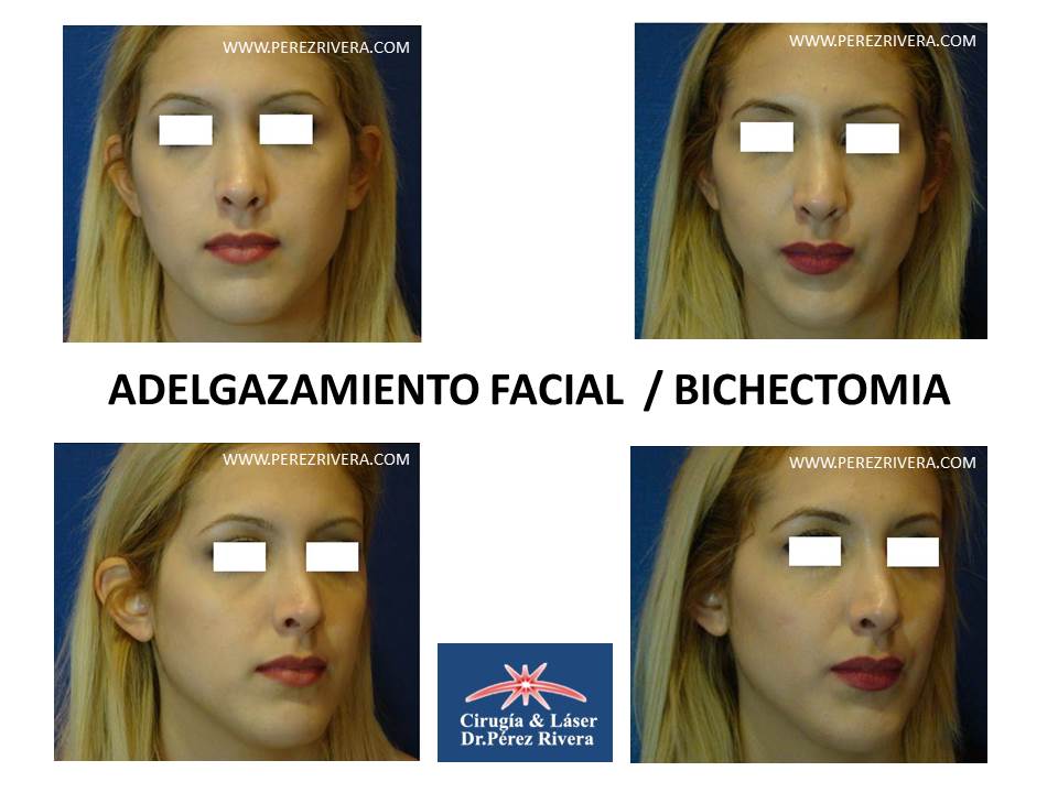 Chau a la Cara Redonda!!